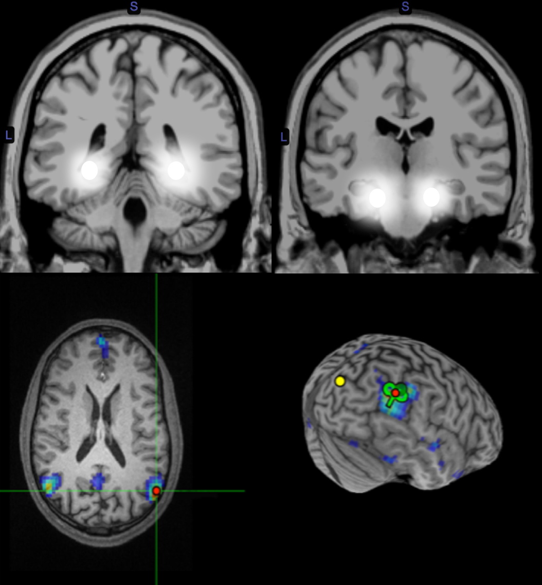 brain_image brain scan