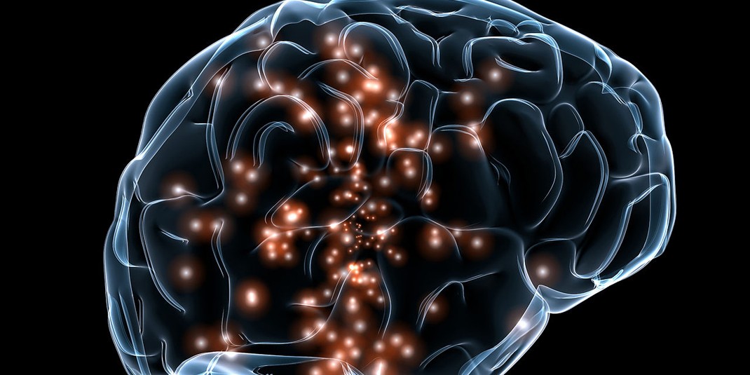 Photo of brain