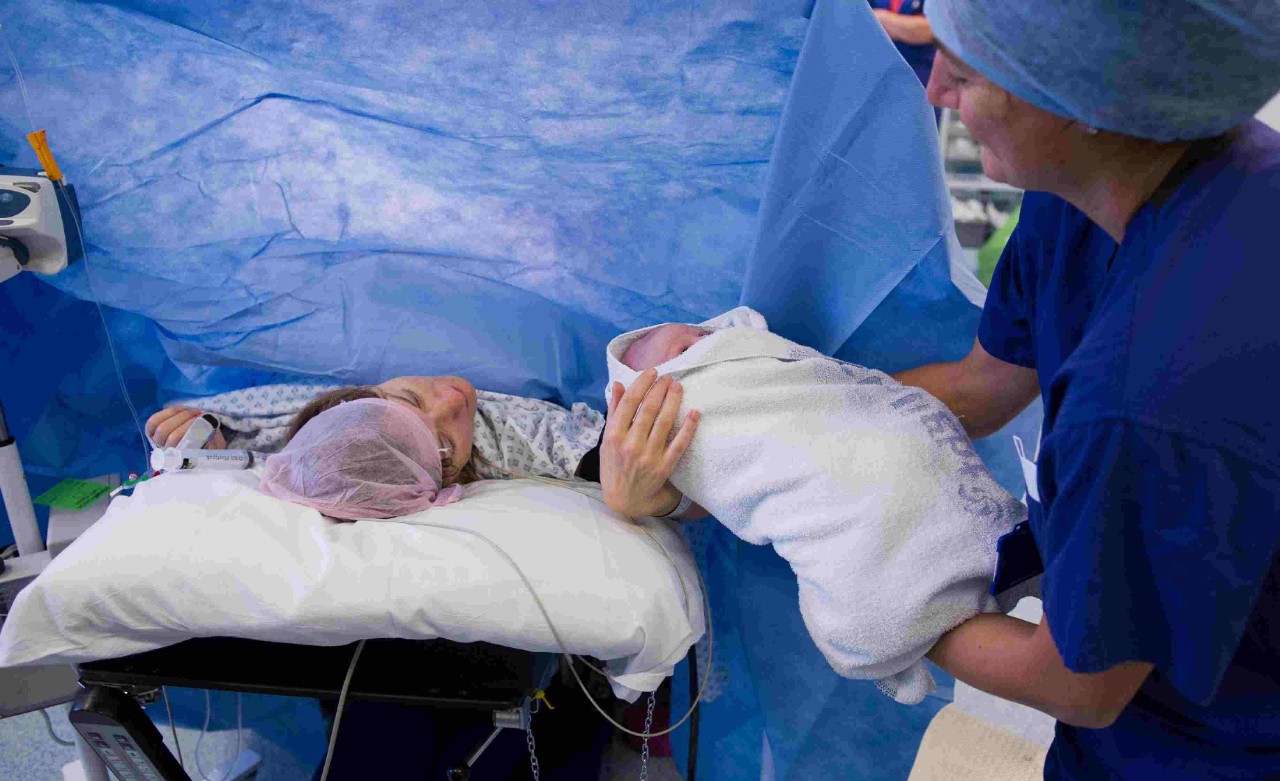 A mother seeing her new born baby for the first time after delivery by Cesarean section