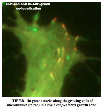 Photo of image from microtubule research
