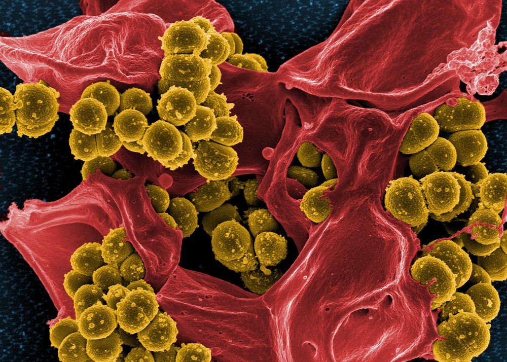 Photo of National Institute of Allergy and Infectious Diseases logo