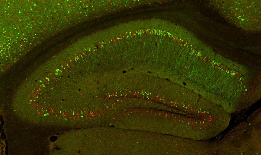 Mouse hippocampus