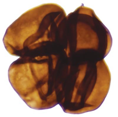Image of a microfossil