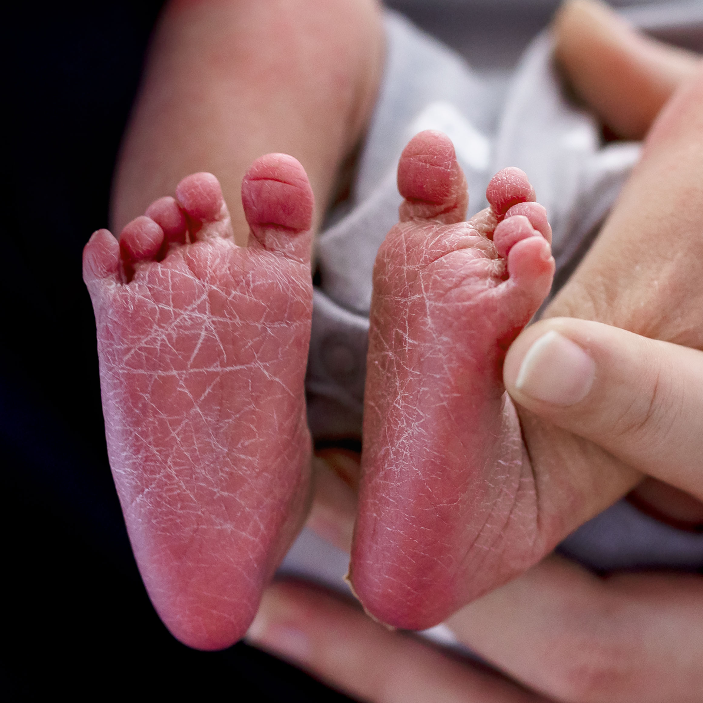 A bottom of a newborn baby's feet