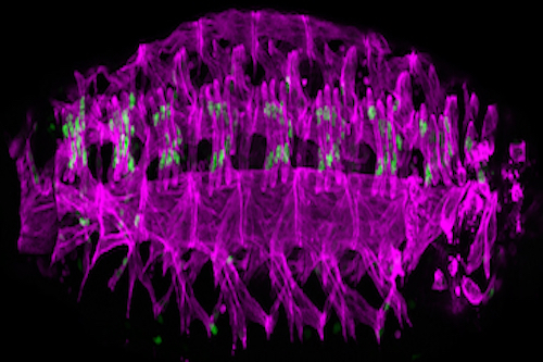 Drosophila embryos showing the muscles (magenta) and the nuclei in a subset of muscles (green).