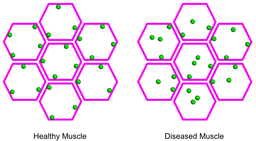 Schematic cross section of muscle fibers (magenta) and nuclei (green).